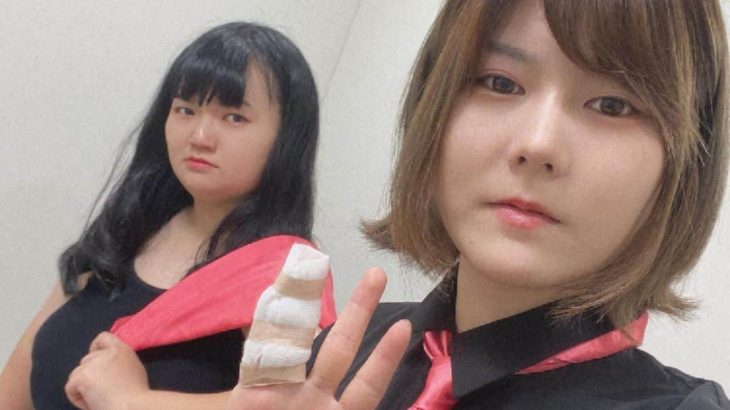 注目の女性芸人がついに告白！目を整形しバキバキな新しい姿に