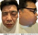【芸能】上白石萌歌、“サンド富澤の顔パンパン”副鼻腔炎に「実は私もなったことがありまして」